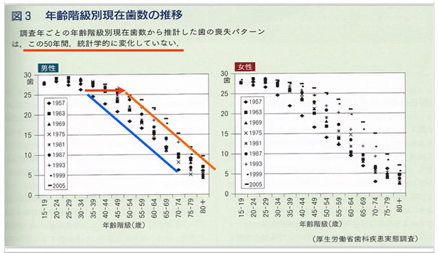 ●ルール1：歯牙欠損進行症を抑制する