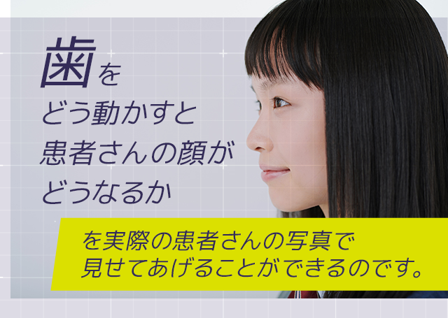 「歯をどう動かすと患者さんの顔がどうなるか」を実際の患者さんの写真で見せてあげることができるのです。