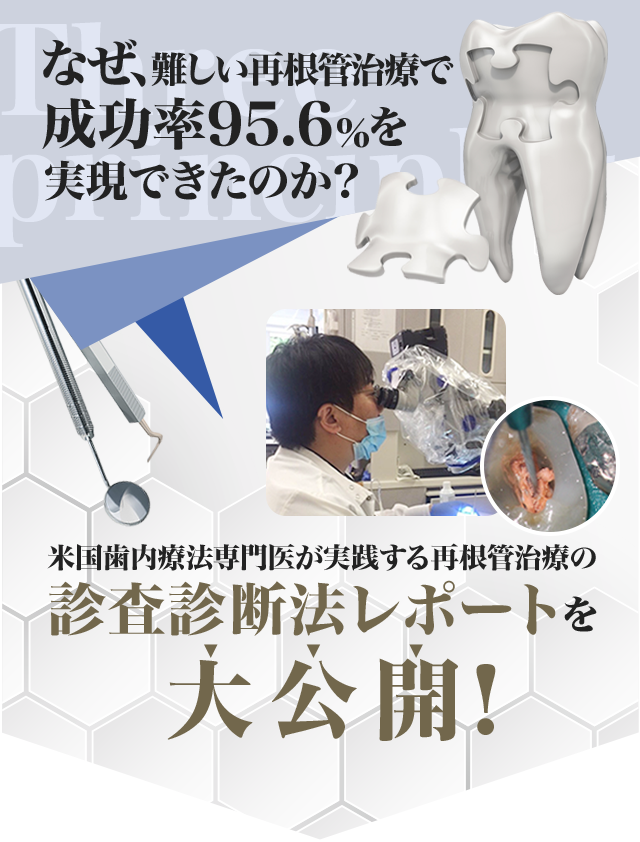 魅力的な価格 米国専門医が伝える成功率95%超えの 再根管治療3つの原則
