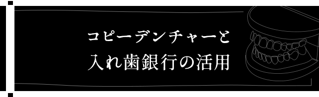 【コピーデンチャーと入れ歯銀行の活用】